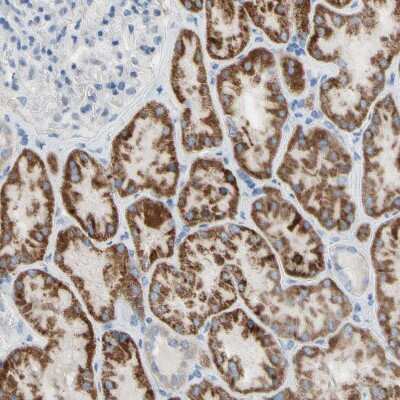 Immunohistochemistry-Paraffin: ACADL Antibody [NBP1-89289]