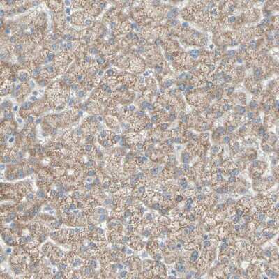 Immunohistochemistry-Paraffin: ACADL Antibody [NBP1-89289]