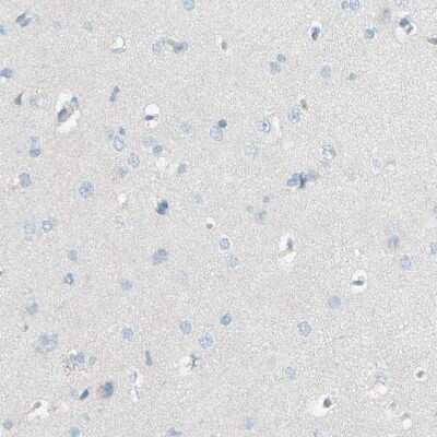 Immunohistochemistry-Paraffin: ACADL Antibody [NBP1-89289]