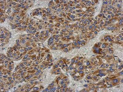 Immunohistochemistry-Paraffin: ACADL Antibody [NBP2-15235]