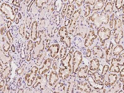 Immunohistochemistry-Paraffin: ACADL Antibody [NBP2-97409]