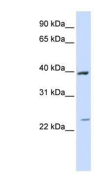 Western Blot: ACADL Antibody [NBP1-54763]