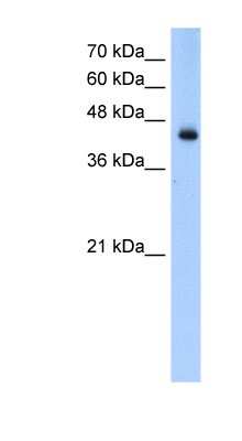 Western Blot: ACADL Antibody [NBP1-54936]