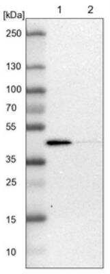 Western Blot: ACADL Antibody [NBP1-89289]