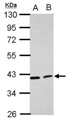 Western Blot: ACADL Antibody [NBP2-15235]