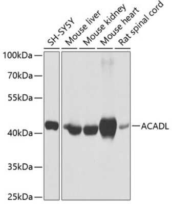 Western Blot: ACADL AntibodyBSA Free [NBP2-92854]