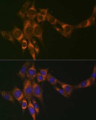 Immunocytochemistry/ Immunofluorescence: ACADM Antibody (1E5G10) [NBP3-16437]