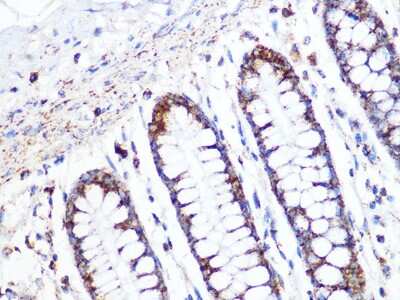 Immunohistochemistry-Paraffin: ACADM Antibody (1E5G10) [NBP3-16437]