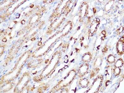 Immunohistochemistry-Paraffin: ACADM Antibody (1E5G10) [NBP3-16437]