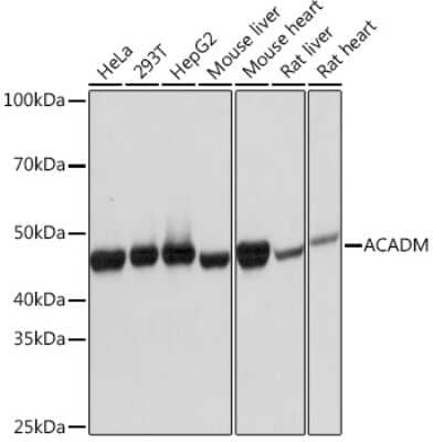 Western Blot: ACADM Antibody (1E5G10) [NBP3-16437]