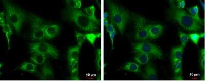 Immunocytochemistry/ Immunofluorescence: ACADM Antibody [NBP1-31397]