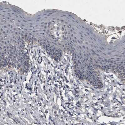 Immunohistochemistry: ACADM Antibody [NBP1-89293]