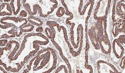 Immunohistochemistry-Paraffin: ACADM Antibody [NBP1-31397]