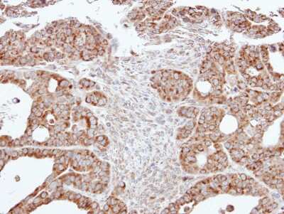 Immunohistochemistry-Paraffin: ACADM Antibody [NBP1-32028]