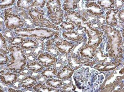 Immunohistochemistry-Paraffin: ACADM Antibody [NBP1-32028]