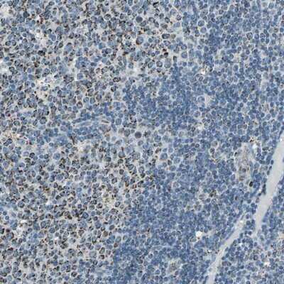 Immunohistochemistry-Paraffin: ACADM Antibody [NBP1-89292]