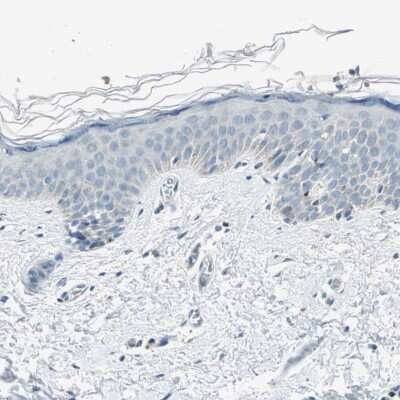 Immunohistochemistry-Paraffin: ACADM Antibody [NBP1-89292]