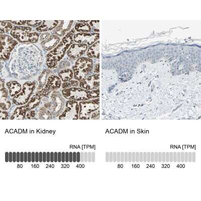 Immunohistochemistry-Paraffin: ACADM Antibody [NBP1-89292]
