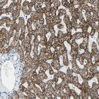 Immunohistochemistry-Paraffin: ACADM Antibody [NBP1-89292]