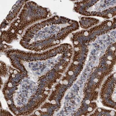 Immunohistochemistry-Paraffin: ACADM Antibody [NBP1-89293]