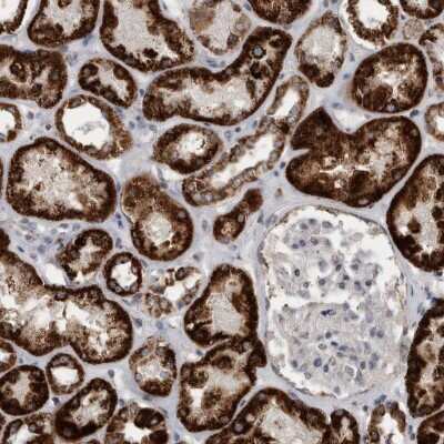 Immunohistochemistry-Paraffin: ACADM Antibody [NBP1-89293]