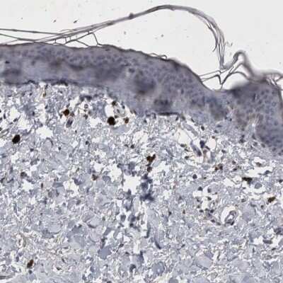 Immunohistochemistry-Paraffin: ACADM Antibody [NBP1-89293]