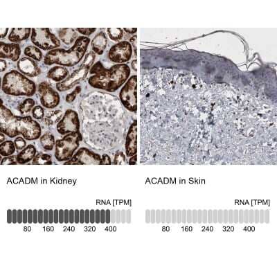 Immunohistochemistry-Paraffin: ACADM Antibody [NBP1-89293]