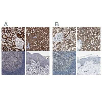 Immunohistochemistry-Paraffin: ACADM Antibody [NBP1-89293]