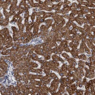 Immunohistochemistry-Paraffin: ACADM Antibody [NBP1-89293]