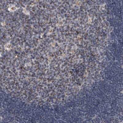 Immunohistochemistry-Paraffin: ACADM Antibody [NBP1-89293]