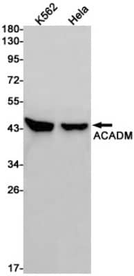 Western Blot: ACADM Antibody (S06-8F7) [NBP3-19554]