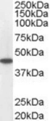 Western Blot: ACADM Antibody [NB100-1121]