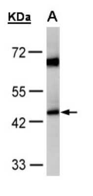 Western Blot: ACADM Antibody [NBP1-31397]