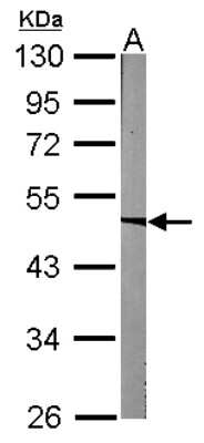 Western Blot: ACADM Antibody [NBP1-32028]