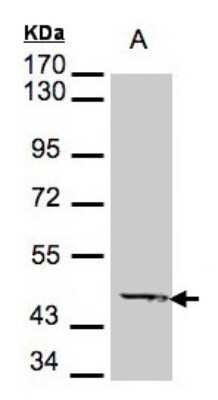 Western Blot: ACADM Antibody [NBP1-32028]