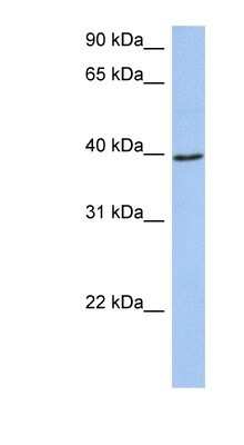 Western Blot: ACADM Antibody [NBP1-54729]