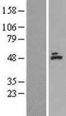 Western Blot: ACADM Overexpression Lysate [NBL1-07220]