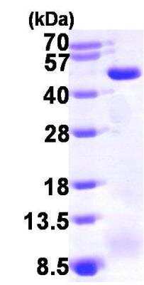 SDS-PAGE: Recombinant Human ACADM His Protein [NBP1-45268]