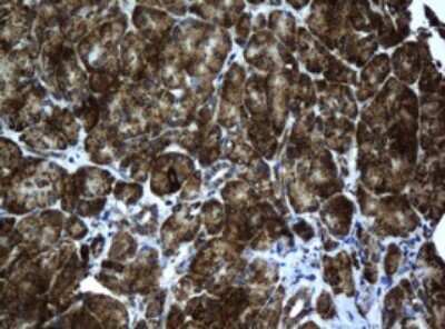 Immunohistochemistry: ACADS Antibody (OTI1D2) [NBP2-45474]