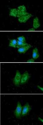 Immunocytochemistry/ Immunofluorescence: ACADS Antibody (8B10) - BSA Free [NBP2-59496]