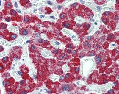 Immunohistochemistry-Paraffin: ACADS Antibody [NBP1-32032]