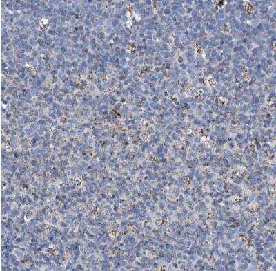 Immunohistochemistry-Paraffin: ACADS Antibody [NBP1-89290]