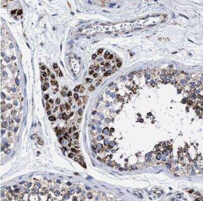 Immunohistochemistry-Paraffin: ACADS Antibody [NBP1-89290]