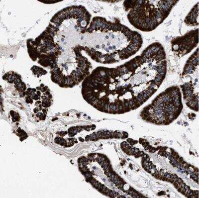 Immunohistochemistry-Paraffin: ACADS Antibody [NBP1-89290]