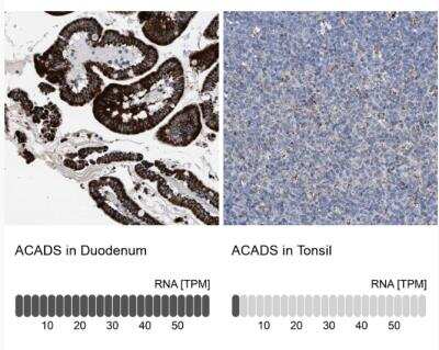 Immunohistochemistry-Paraffin: ACADS Antibody [NBP1-89290]