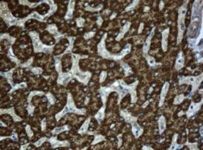 Immunohistochemistry: ACADS Antibody (OTI1D2) - Azide and BSA Free [NBP2-70061]