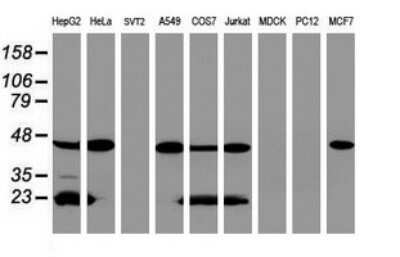 Western Blot: ACADS Antibody (OTI1D2)Azide and BSA Free [NBP2-70061]