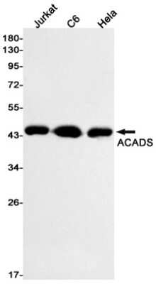 Western Blot: ACADS Antibody (S08-4C2) [NBP3-14990]