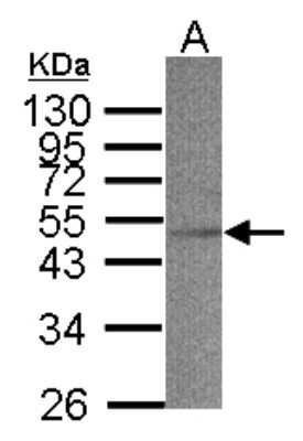 Western Blot: ACADS Antibody [NBP1-32032]