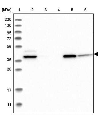 Western Blot: ACADS Antibody [NBP1-89290]